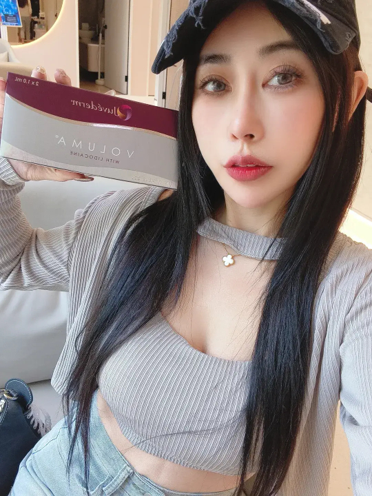 施作心得：快速、精準，而且真的不痛！｜見證案例-Angel緁希